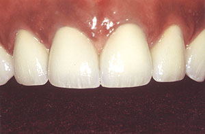 Smile gallery image