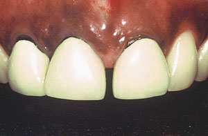 Smile gallery image