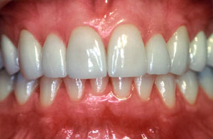Smile gallery image