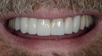 Smile gallery image