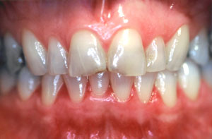 Smile gallery image