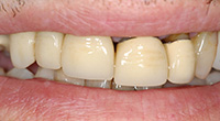 Smile gallery image