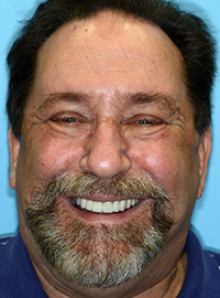 Smile gallery image