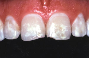 Smile gallery image