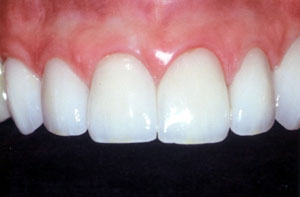 Smile gallery image