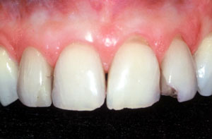 Smile gallery image