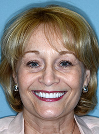Smile gallery image