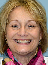 Smile gallery image