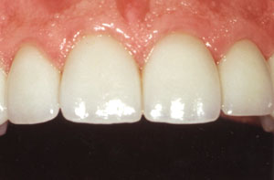 Smile gallery image