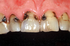 Smile gallery image