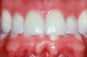 Smile gallery image