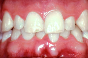Smile gallery image