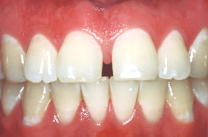 Smile gallery image