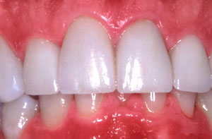 Smile gallery image