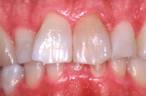 Smile gallery image