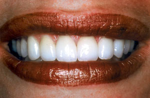 Smile gallery image