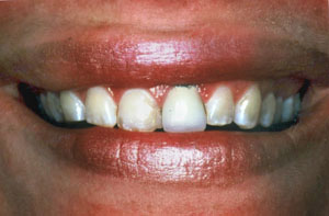 Smile gallery image