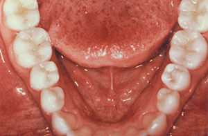 Smile gallery image